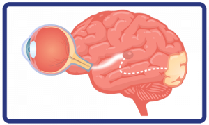 optic nerve