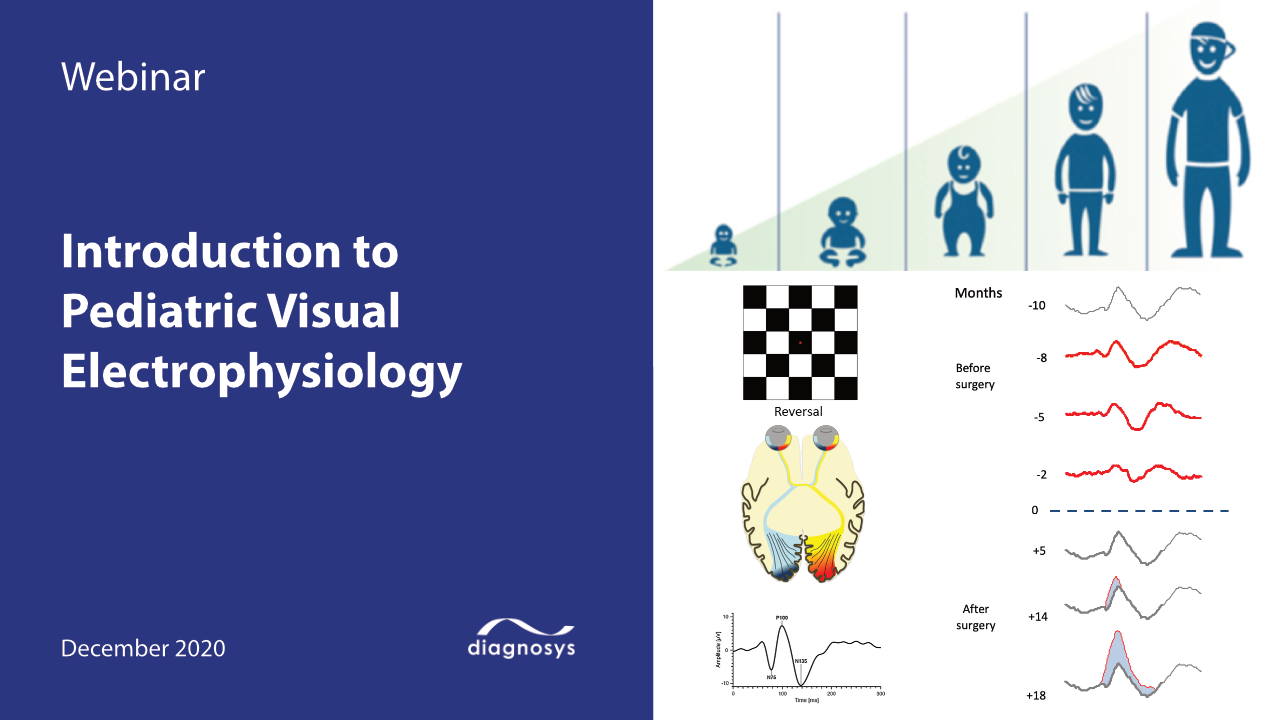 Introduction to Pediatric Visual Electrophysiology Testing