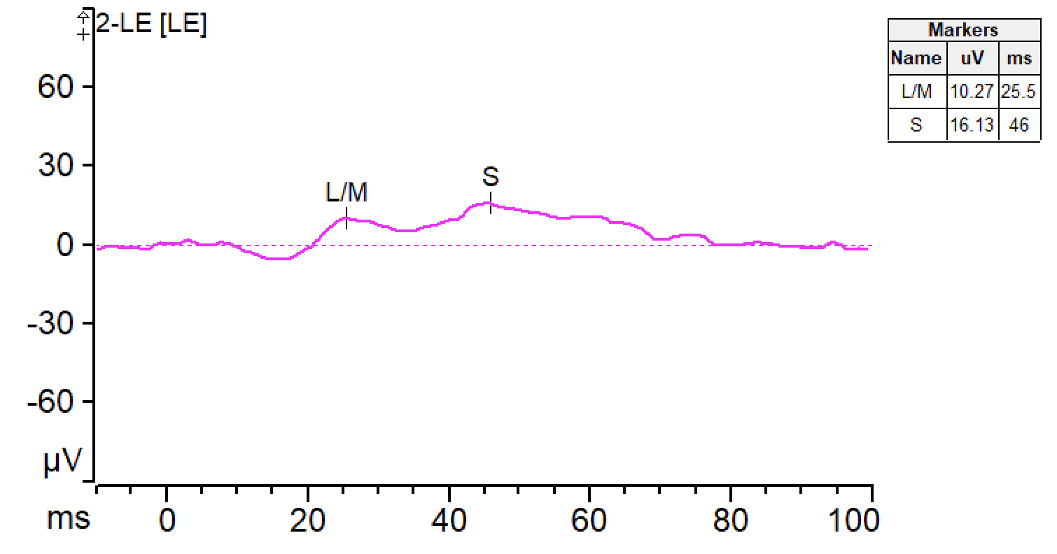 SCone ERG Diagnosys LLC