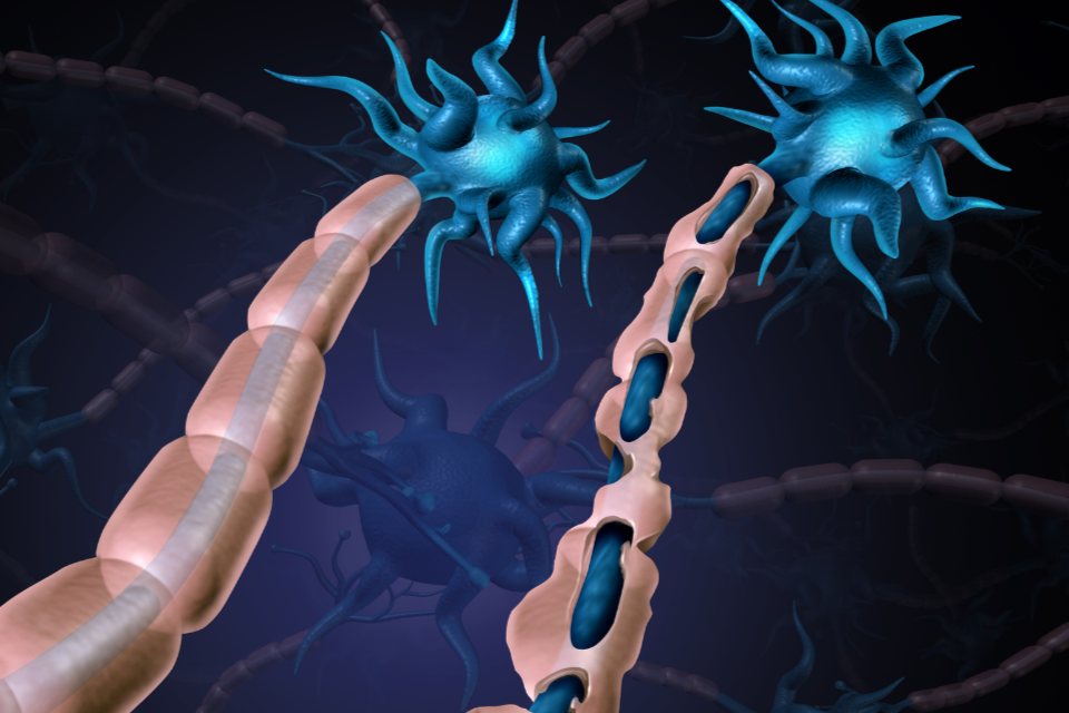Visual Electrophysiology Supports Clinical Trials of Remyelinating Drugs for Multiple Sclerosis