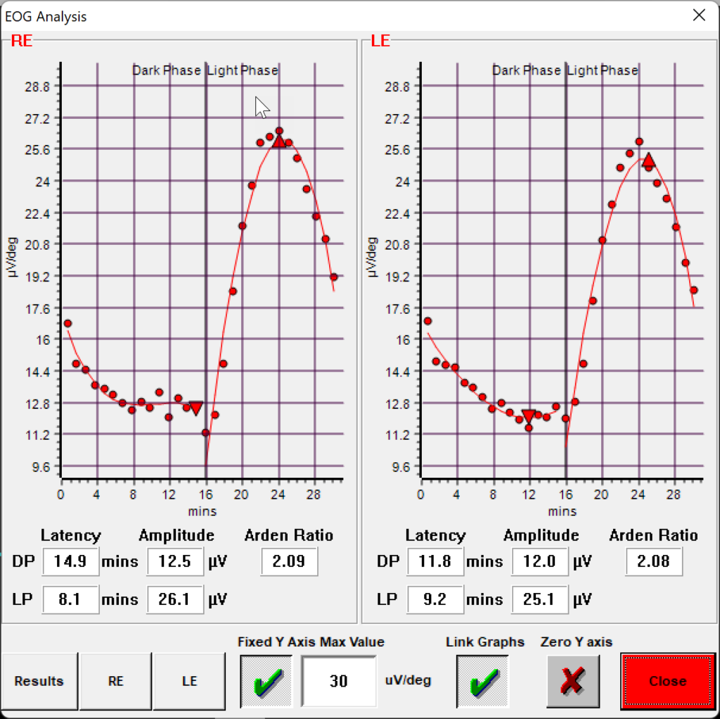 EOG Arden Ratio