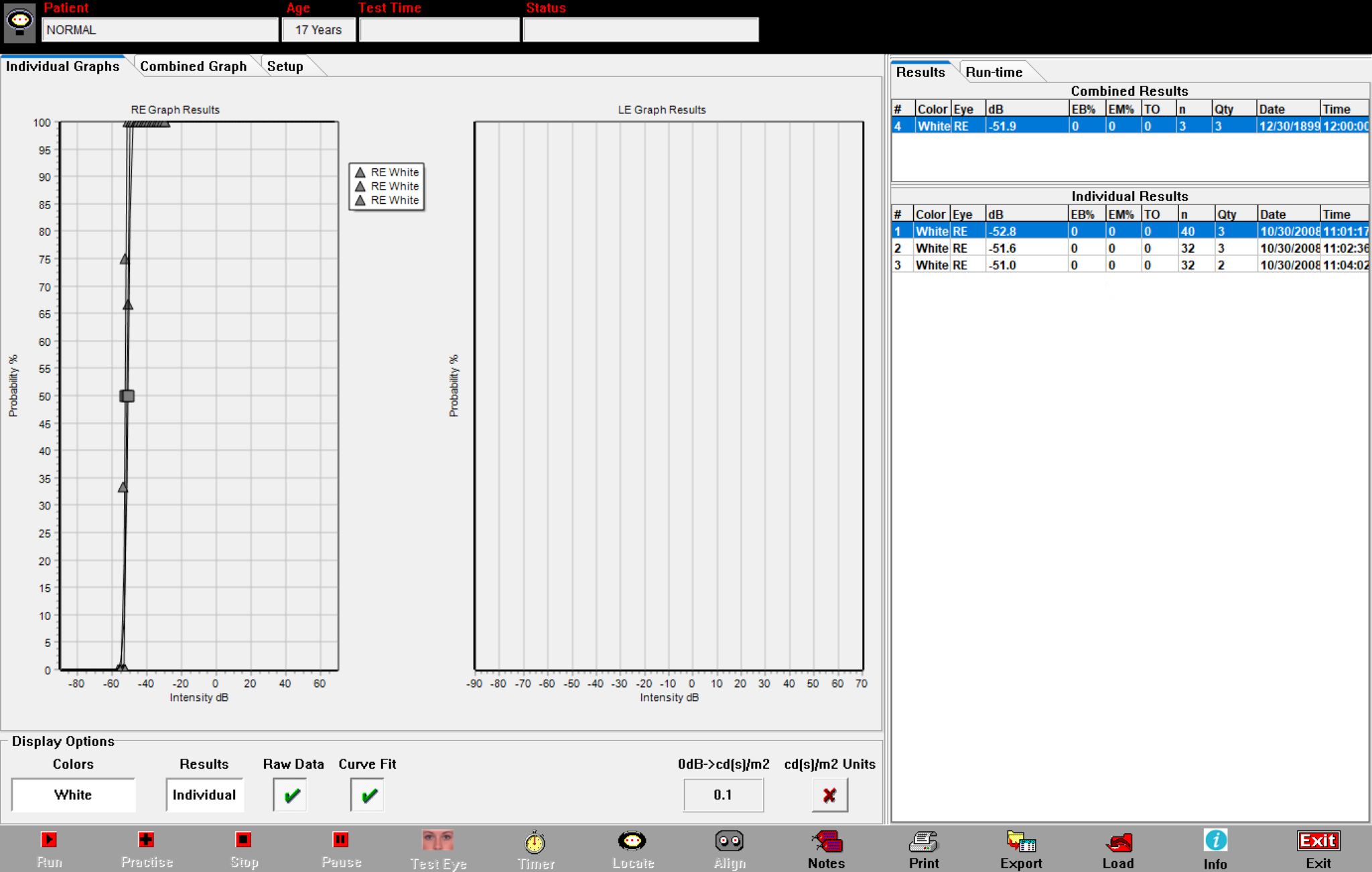 Fullfield Stimulus Threshold (FST) Diagnosys LLC