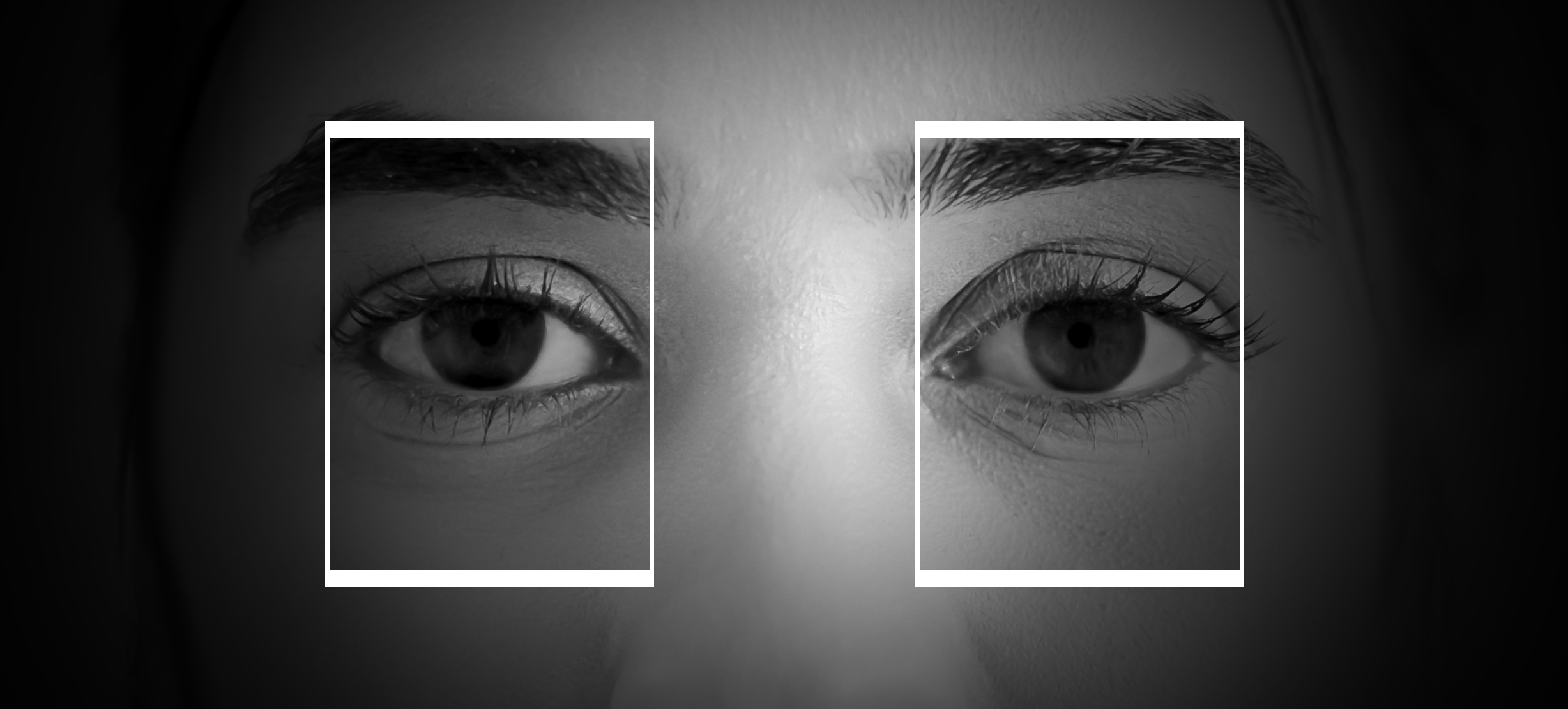 Pupillometry infrared image