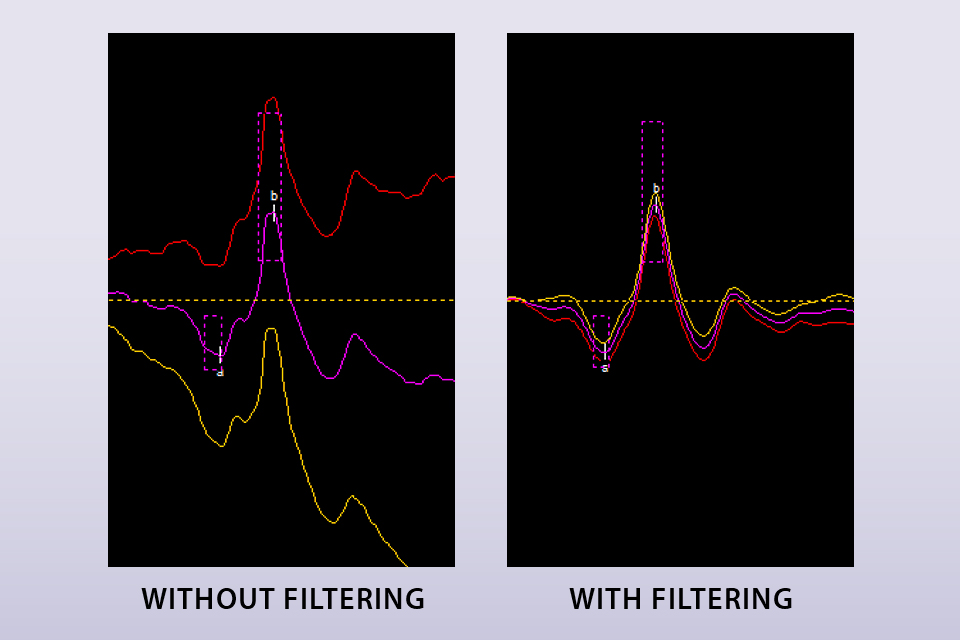 Before and after applying the bandpass filter, a feature available starting with Espion software V7