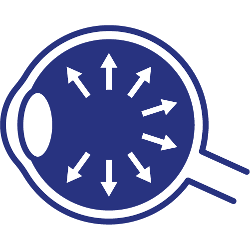 Glaucoma icon