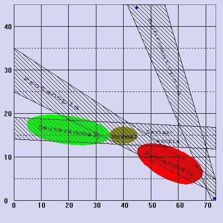 Image from the webinar by Wendy Harrison