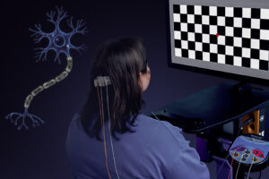 Measuring remyelination: VEP in multiple sclerosis clinical trials